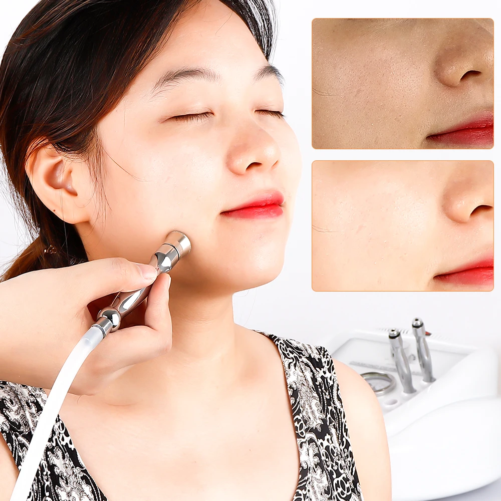 New Microdermabrasion Machine Dermabrasion Anti Aging Wrinkle Blackhead Remover Facial Peeling Water Spray Exfoliation 40