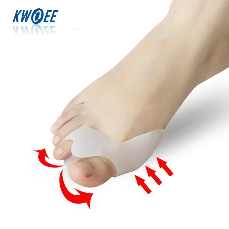 1 Lot=2 Pairs Hallux Valgus Aligner Foot Thumb Rehabilitation Big Toe Separator Alluce Valgo Adjustment Toe Corrector Feet Care