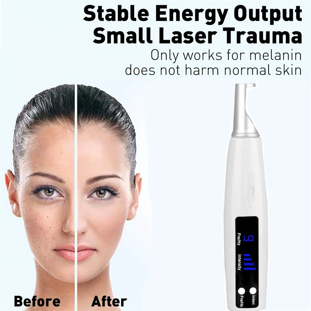 Laser Picosecond Mole Removal Pen Professional Tattoo Freckle Acne Mole Dark Spot Pigment Removal Machine Beauty Equipment