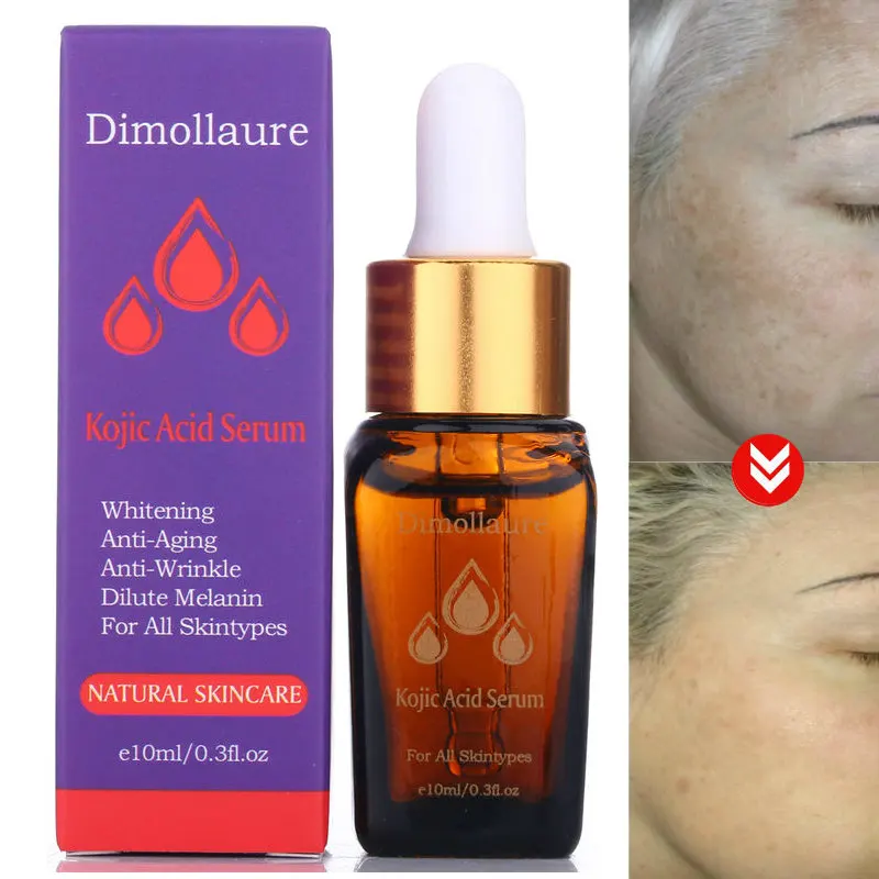 melasma serum