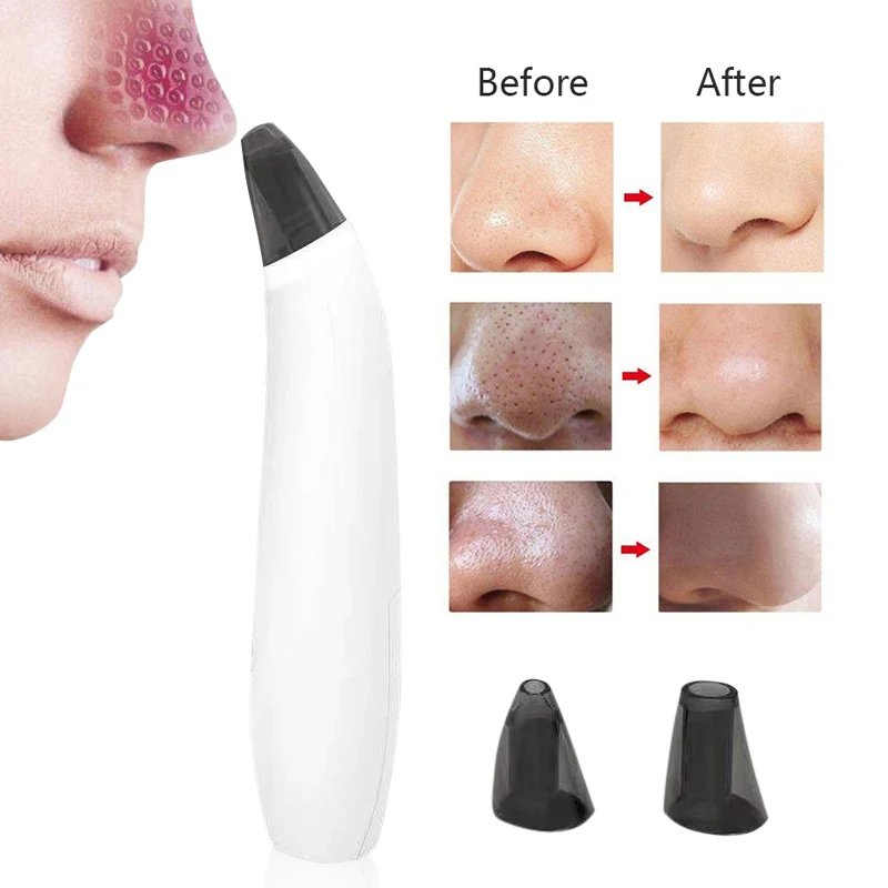 

Manufacturer Deep Face Clean Blackhead Remover Electric Blackhead Cleaner Facial Acne Instrument Pore Cleaner Blackhead Vacuum