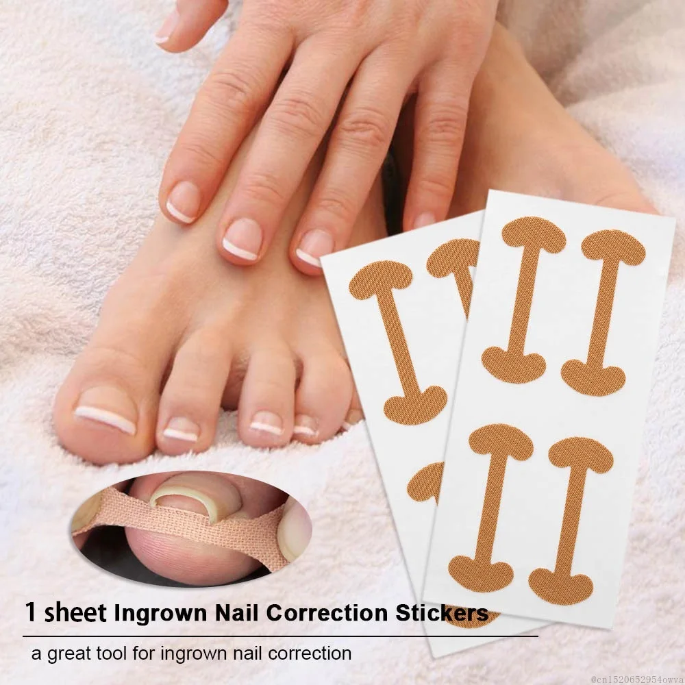 

4 Stickers/sheet Ingrown Toenail Correction Tool Toe Nail Treatment Elastic Patch Sticker Straightening Clip Brace Pedicure Tool