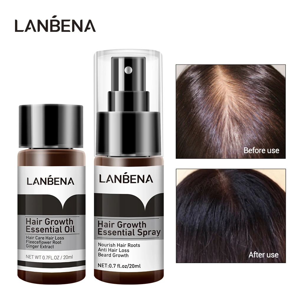 Top 127 + Why do hair roots hurt polarrunningexpeditions