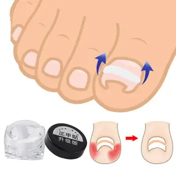 

Ingrown Toe Nail Correction Wire Fixer Pedicure Paronychia Recover Treatment Recover Sticker Foot Care Tool