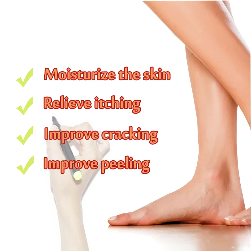1pcs Powerful Hand Foot Crack Cream Heel Chapped Peeling Foot And Hand Repair Anti Dry Crack Skin Care Chinese Ointment S012