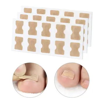 

10/100PCS Ingrown Toenail Corrector Sticker Paronychia Treatment Fixer Recover Corrector Pedicure Foot Toe Nail Care Tool Set