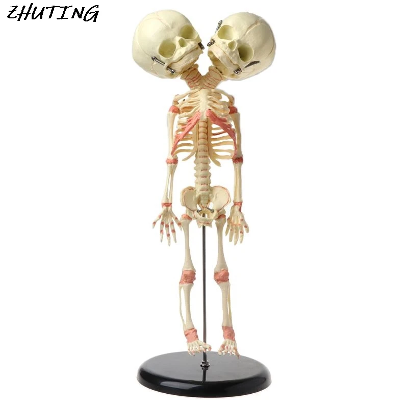 

37cm Human Double Head Baby Skull Skeleton Anatomy Brain Display Study Teaching Anatomical Model