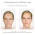 HNKMP Eye Face Massager Electric Vibration Anti-aging Anti-wrinkle Promote Nutrition Puffiness Removal For Eye Fatigue
