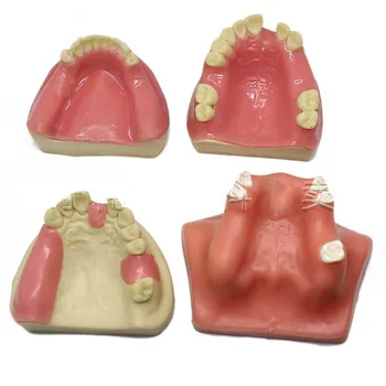 

Dental implant training model Oral implant training practice model Maxillary sinus lifting exercises
