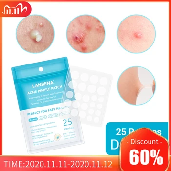 

LANBENA Face Mask Acne Treatment Facial Mask Skin Care Acne Pimple Remover Tools Patches Stickers Black Mask Peeling Face Masks