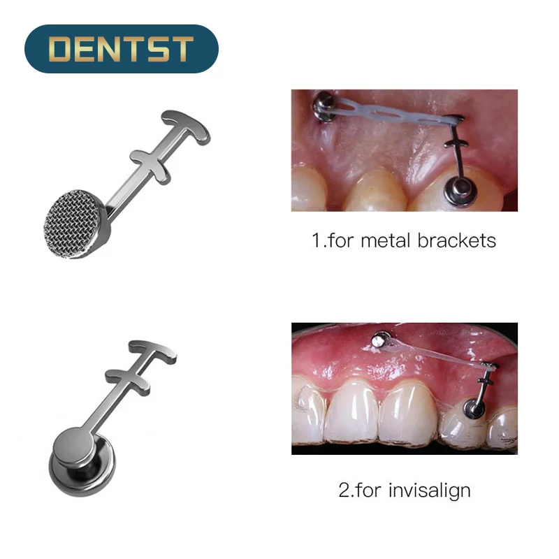 Dentst 10Pcs Multi-Hook Bondable Bracci Ortodontici Staffe Bottoni Linguali Dentali Gancio Crimpabile Incollabile Per Invisalign