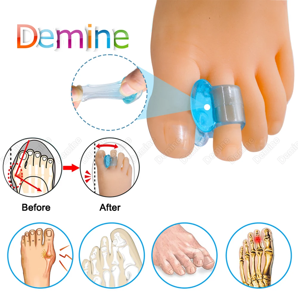 

Soft Silicone Gel Toe Separator Hallux Valgus Bunion Corrector Toes Bone Straightener Adjuster Orthotic Inserts Foot Care Tool