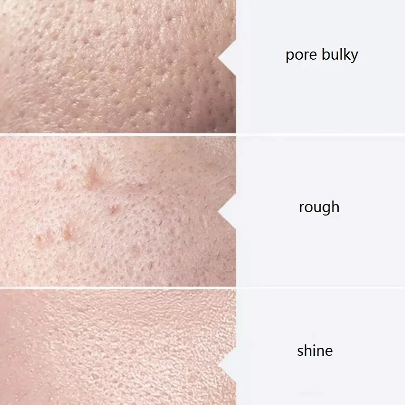 Aqua Peel Skincare Solution 400ml per for Oxygen Jet Small Bubble Machine