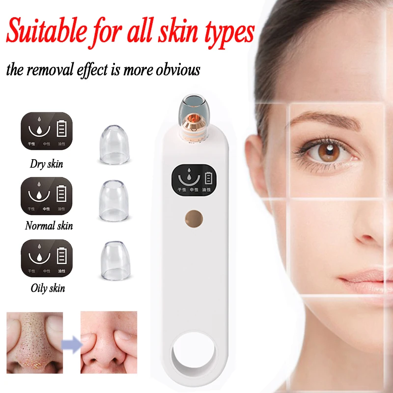 Black Dot remover in facial skin care tools Electric blackhead acne removal vacuum cleaner Facial vacuum cleansing pore tools 3