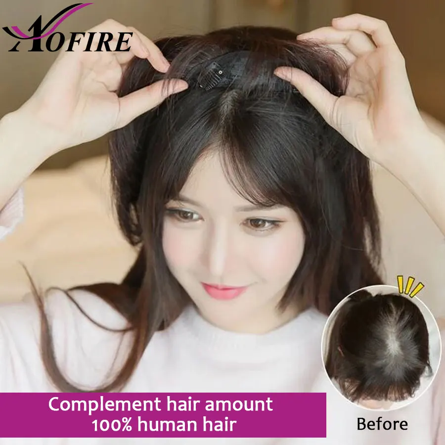 头皮对比1 - 副本