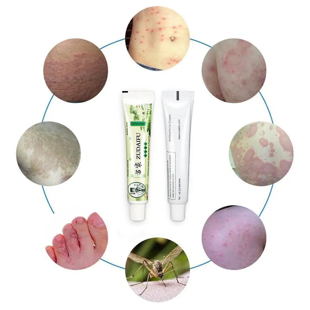 10 шт., крем zudaifu Eczema, псориаз, дерматит, экзематоид, лечение зуда, мазь, псориаз, крем, зуд, Большая распродажа 11,11