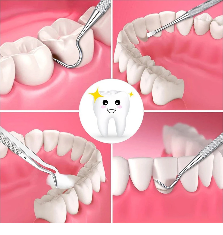 Стоматологический гигиенический инструмент, зубной камень, скребок, стоматологическое оборудование, удаление налета, чистка зубов, нержавеющая сталь, инструмент для ухода за полостью рта