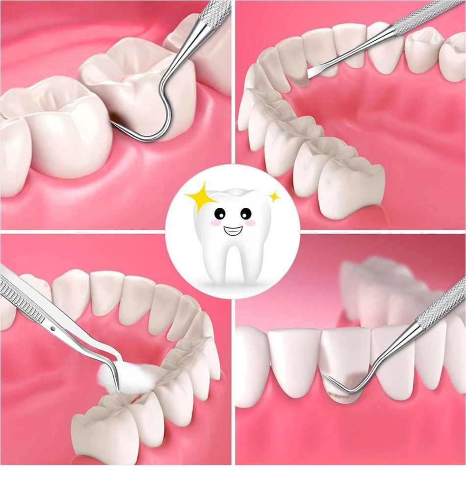 A1-详情模板-切片版_13