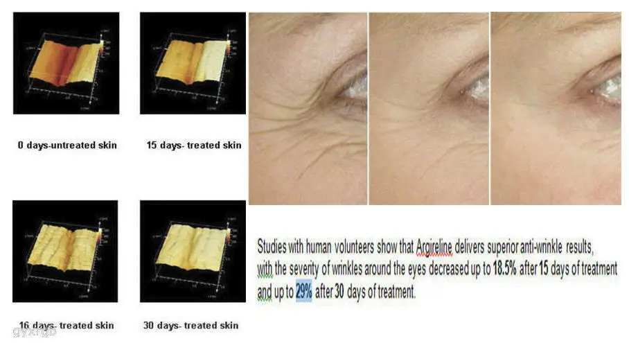 

Triple lifting eye gel wrinkle lines Eye Cream Moisturizing Anti Puffiness Woman 3000 anti-aging eye cream