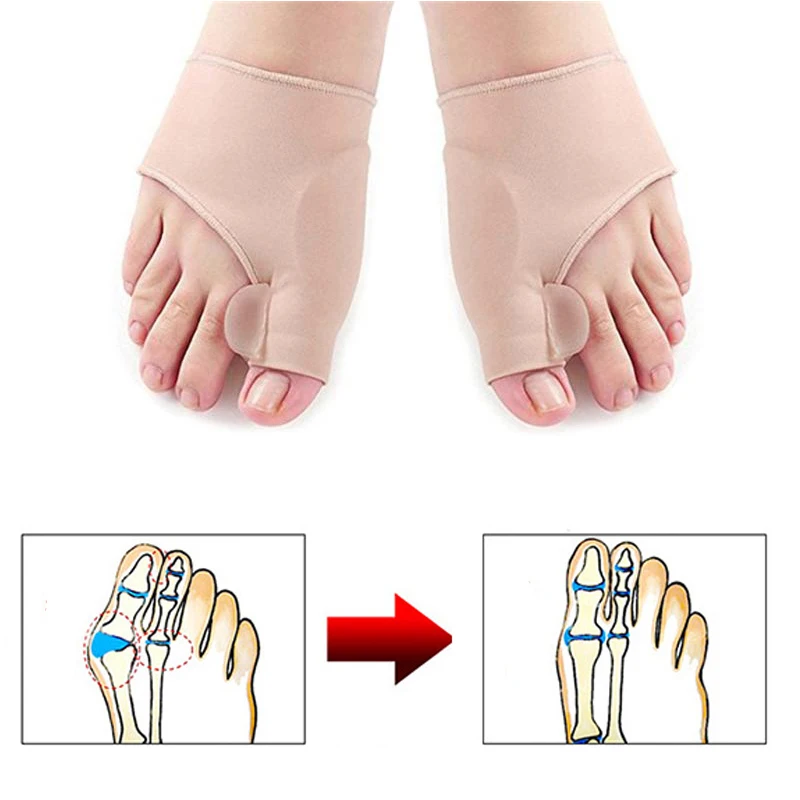 10Pair Big Bone Orthopedic Bunion Correction Pedicure Sock Silicone Hallux Valgus Corrector Brace Toes Separator Feet Care Tools