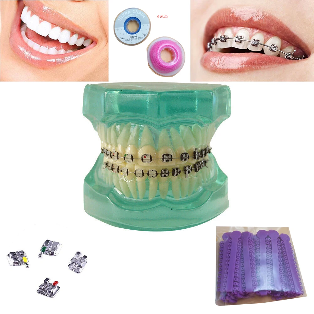 

Teeth Whitening Equipmment Dental Implant Restoration Teaching Study Model Medical Science Dentist Brace Dentistry Nit Products