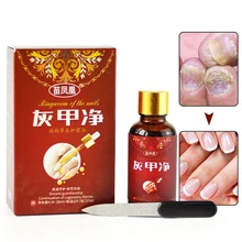 Травяной Антибактериальный раствор для ногтей Лечение онихомикоза стерилизация для удаления грибка для ногтей