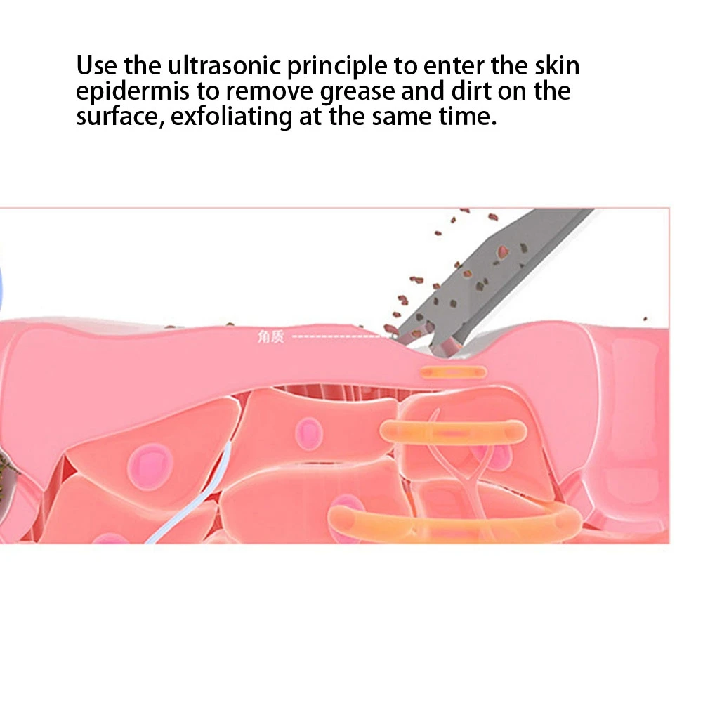 Скребок для кожи лица Электрический спа нежный для удаления угрей, ультразвуковое средство очистки для лица лопаточка Массажер для подтяжки лица чистой