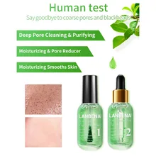 Черная маска для удаления угрей, против акне, очищающая от угрей, Усадочные поры лица, сыворотка, набор с 100 шт., маска для носа