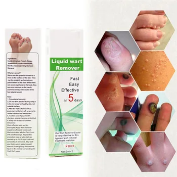 

2Pcs Genital Wart Treatment Papillomas Removal Of Warts Liquid From Skin Tags Removing Against Moles Remover Wart Removal Liuld