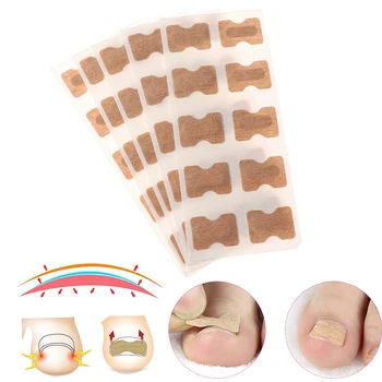 

50pcs Practical Ingrown Toenail Corrector Stickers Paronychia Treatment Recover Corrector Fingernail Toe Nail Care