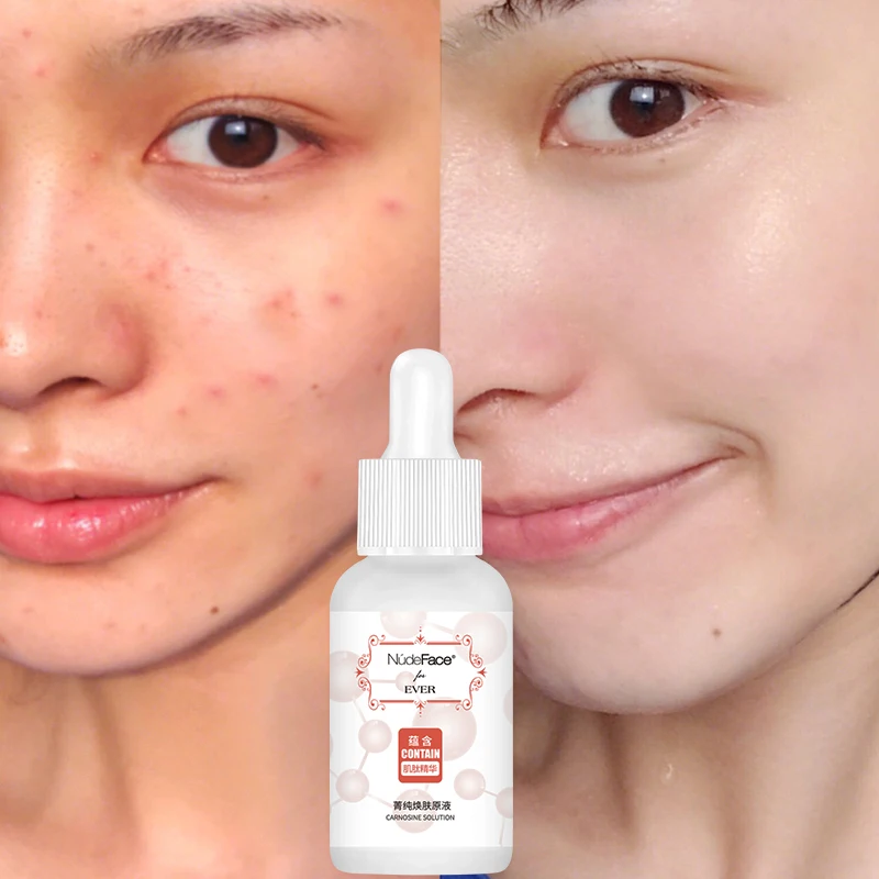Face serum whitening essence Hyaluronic Acid bifida ferment lysate solution Anti-Aging Acne Shrink pores Hydration skin care | Красота и
