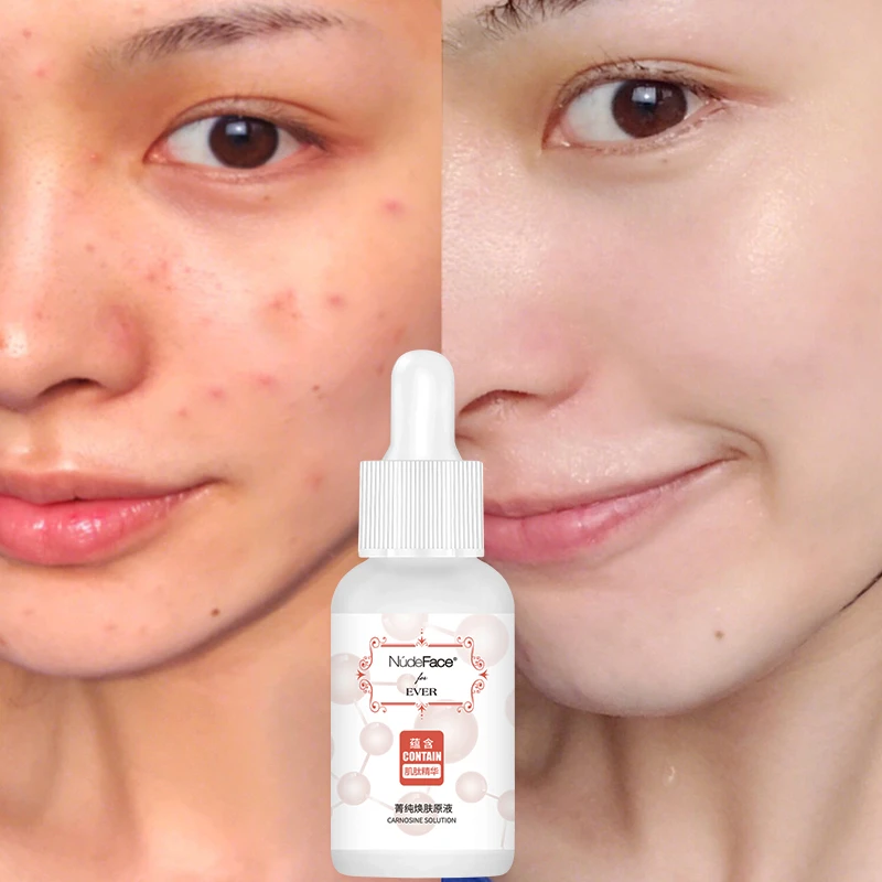 aveeno skin relief moisture repair cream 311g