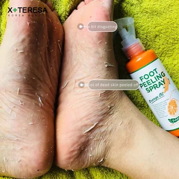 Japan Cosmetics Foot Peeling Spray Natural Orange Essence Pedicure Hands Dead Skin Exfoliator Mask Whiten Baby Foot Care Tool