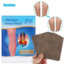 

6pcs/bag Herbal Varicose Veins Treatment Patches Treat Vasculitis Phlebitis Spider Sticker Varicosity Angiitis Medical Plaster