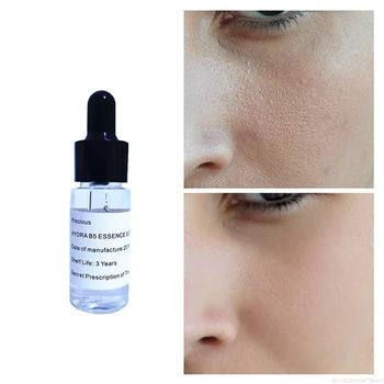 

Blackhead Acne Treatment Negative Oxygen Ions Essence Fast Pore Refining Essence Retinol Nutrient Cream Anti Wrinkle Esseence