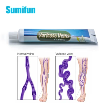 

3pcs Varicose Veins Ointment Vasculitis Treatment Phlebitis Angiitis Inflammation Blood Vessel Rotten Legs Varicose Veins Cream
