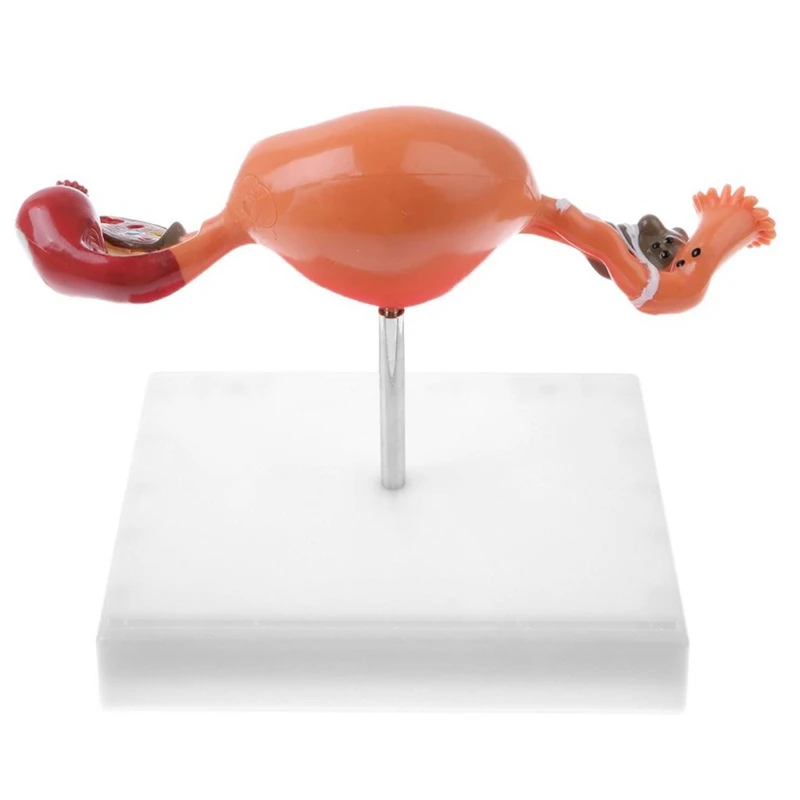 Ovary and Uterus Disease Dissection Model Pathology Uterus Model Teaching Human Medical Aids Anatomy Lesion Uterus