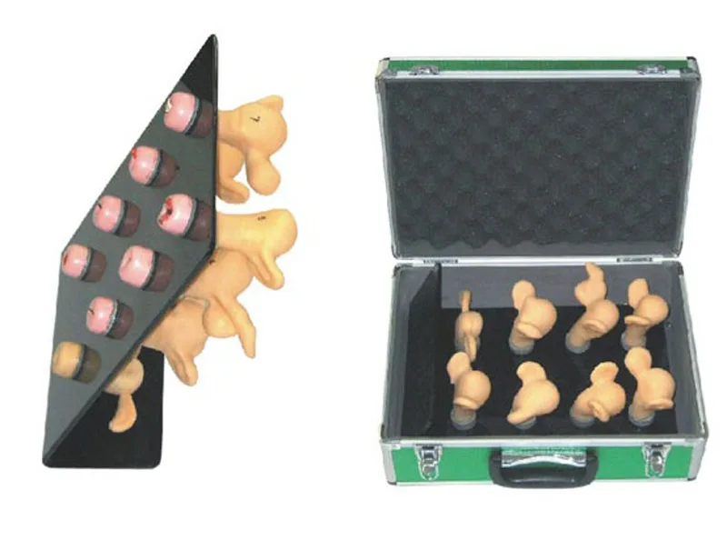 ZK Model of cervical lesions