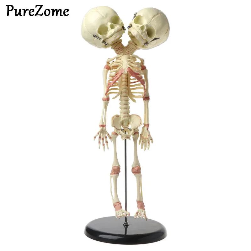  37cm Human Double Head Baby Skull Skeleton Anatomy Brain Display Study Teaching Anatomical Model - 4000040622886