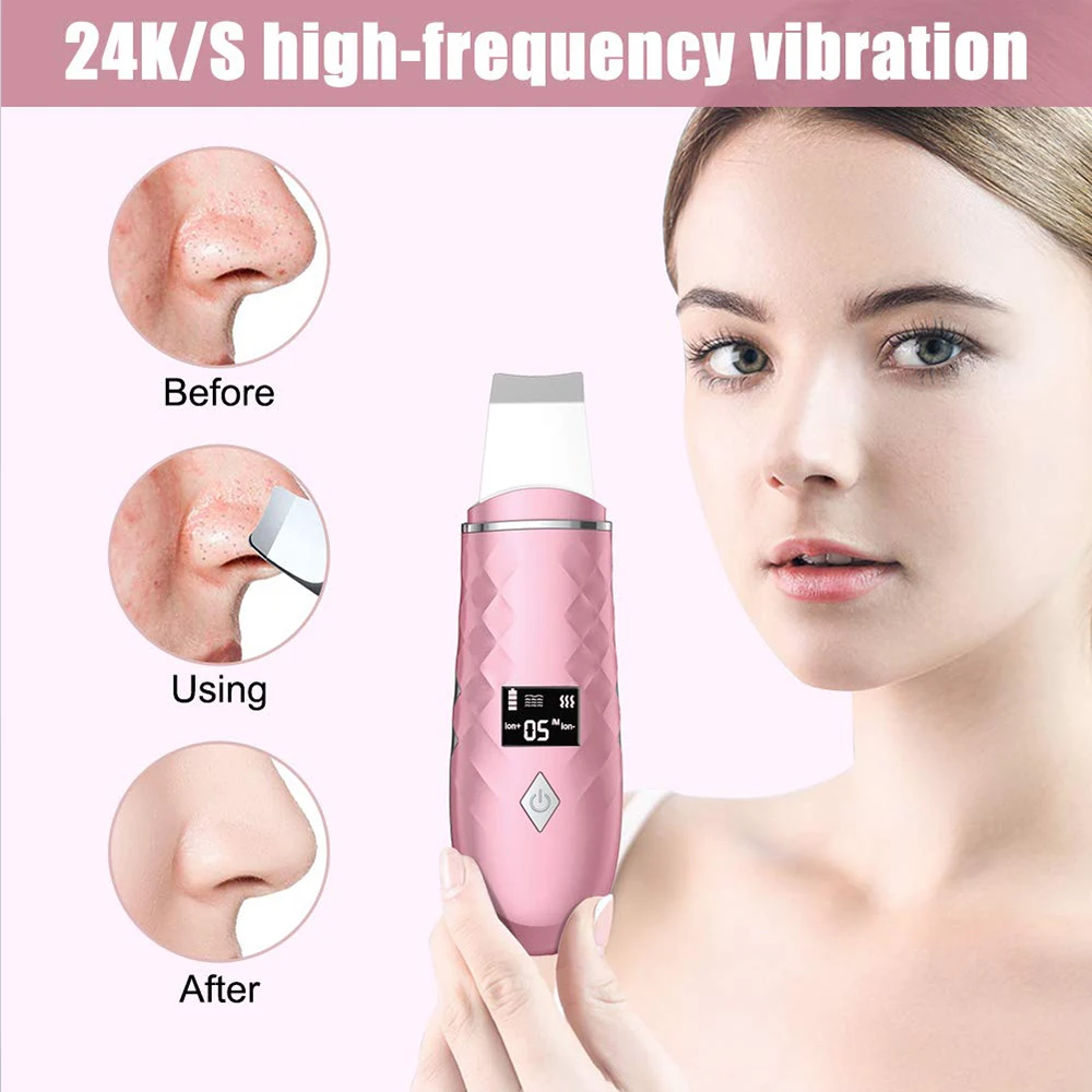 EMS Skin Scrubber,Ultrasonic Facial Skin Spatula,36-42&deg;C Heating Facial Cleansing,Blackhead Remover Extractor,Face Cleaning Tool