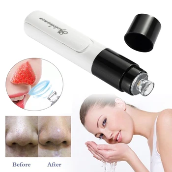 

Practical Electric Blackhead Acne Remover Vacuum Suction Facial Pore Cleaner Vacuum Blackhead Sucker Blackhead Remover Suction