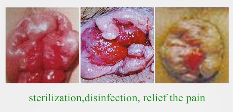 1 шт. геморроя мазь вьетнамский Китайский крем для обезболивания боли внешняя Анальная трещина медицинский пластырь