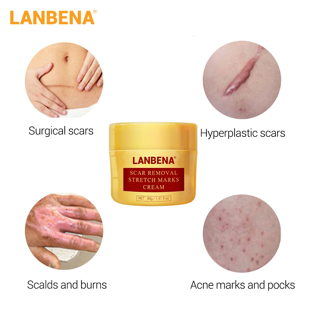 LANBENA Scar Removal Cream Acne Treatment Stretch Marks Remover Surgical Scar Burn For Body Skin Repair 5
