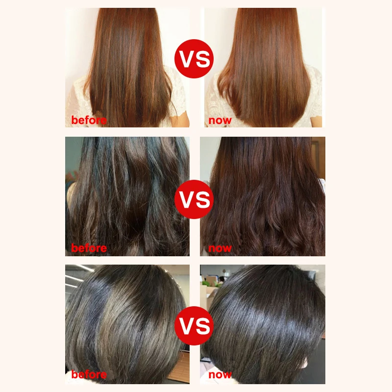 Hair Care Products Zhangguang 101 Ginger Nourishing Conditioner 360g Anti Hair Loss Chinese Medicine Therapy Hair Care Guaranteed 100% Genuine