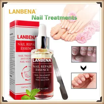 

LANBENA Mild Nail Treatments Essence Effective Remove Onychomycosis Serum Fungal Nail Repair Quicky Nail Nourishing Brighten