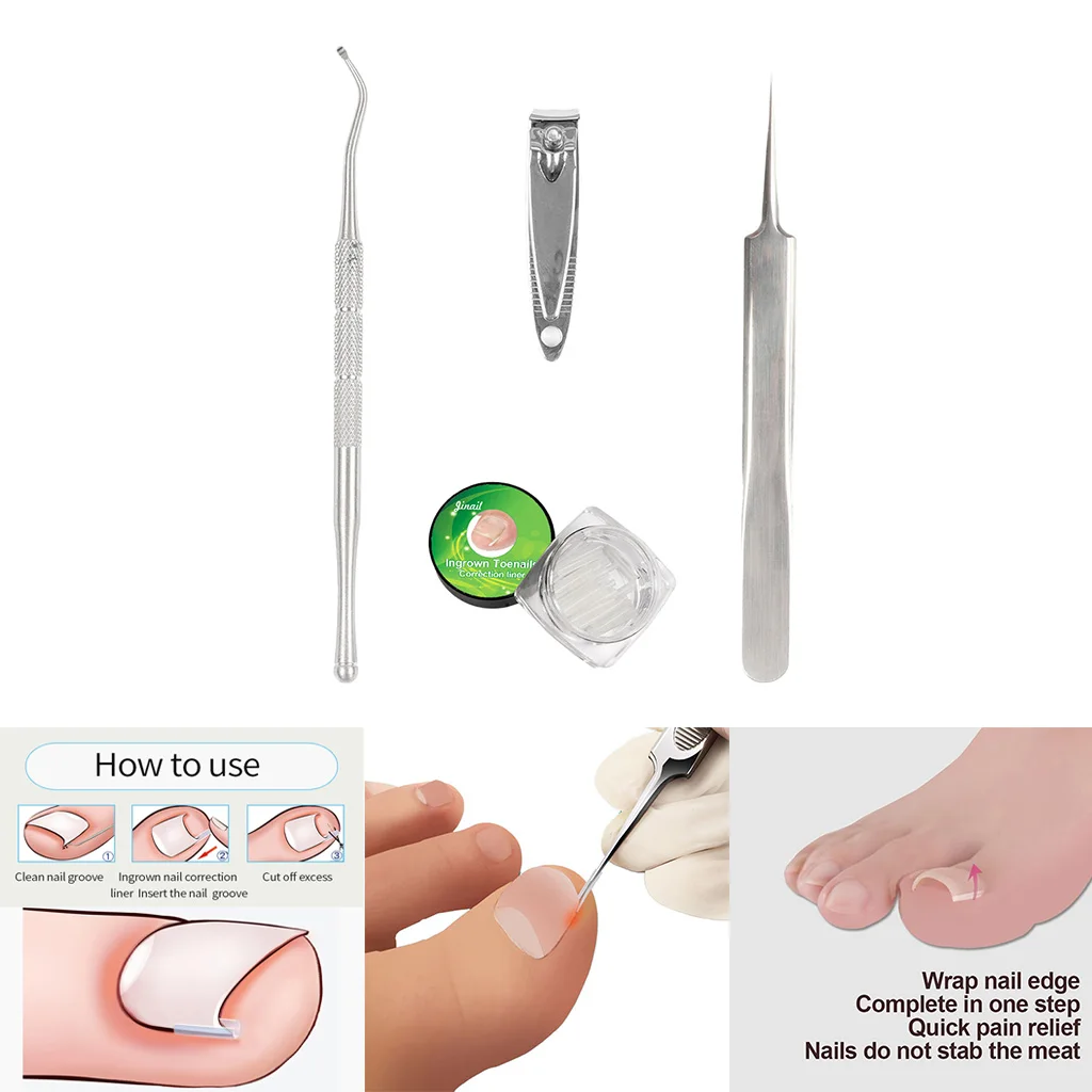 Professional Ingrown Toenail Lifter Correction Tools Toe Nail File Clippers Nail Cleaner Manicure Pedicure Podiatry Tool Professional Ingrown Toenail Lifter Correction Tools Toe Nail File Clippers Nail Cleaner Manicure Pedicure Podiatry Tool