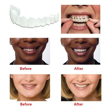 

Whitening Snap Perfect Smile Teeth Fake Tooth Cover On Smile Instant Teeth Cosmetic Denture Care Comfort Fit Snap On Upper Teeth