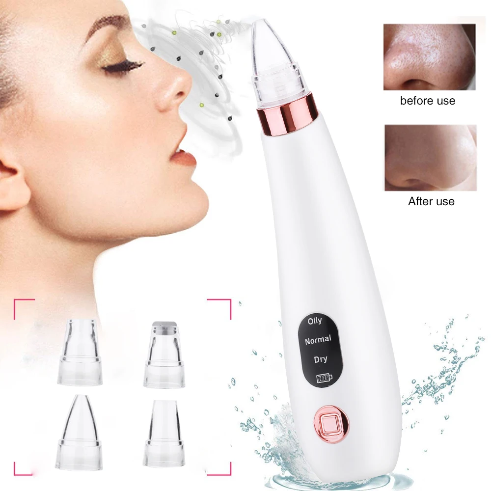 Clear Beauty Remove Blackhead Blackhead Removal Equipment ABS White Black Head Cleaner Cosmetic Instrument Fashion Effective
