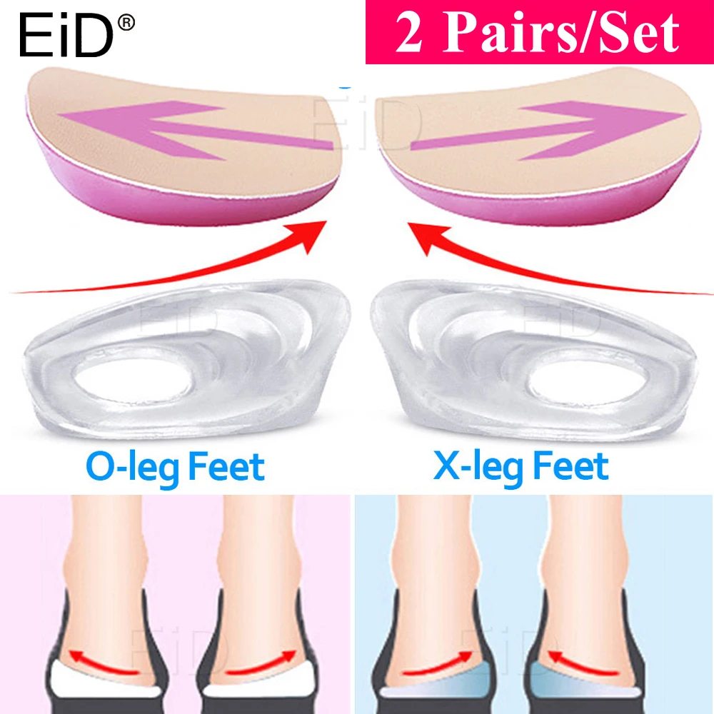 

Silicone Gel XO Legs Orthotic Insoles Silicone Gel Arch Support Pad for Women Flat Foot Orthopedic Inserts Pain Relief Shoe pad