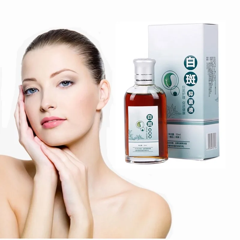 

Professional Care Treatment Skin White Spot Vitiligo Eczema Net health Care Solution repair melanin
